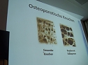 Wissenswertes zur Knochengesundheit (Foto: Thomas Leipold)
