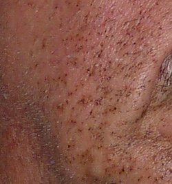 Kleckserei (Foto: Karl-Heinz Herrmann)