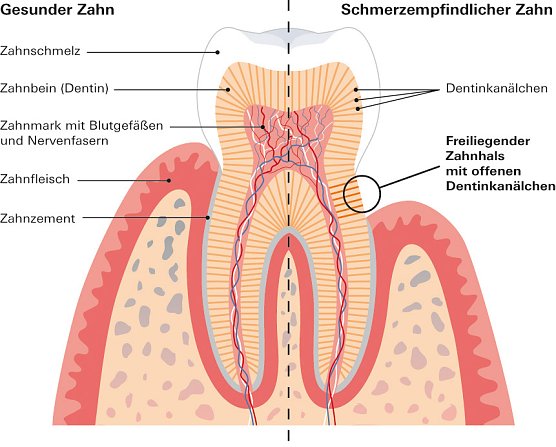Grafik (Foto: Stiftung Warentest)