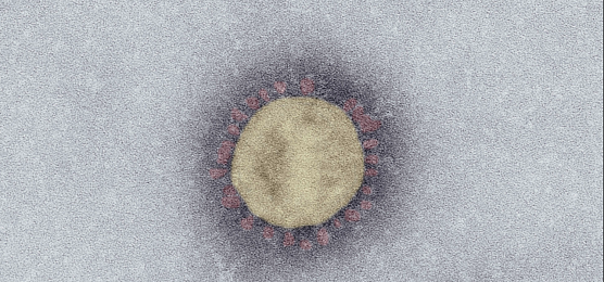 SARS-Coronavirus-2 (SARS-CoV-2, Isolat SARS-CoV-2/Italy-INMI1). Elektronenmikroskopie, Negativkontrastierung (PTA). Ma&szlig;stab: 100 nm (Foto: Robert Koch-Institut: SurvStat@RKI 2.0)