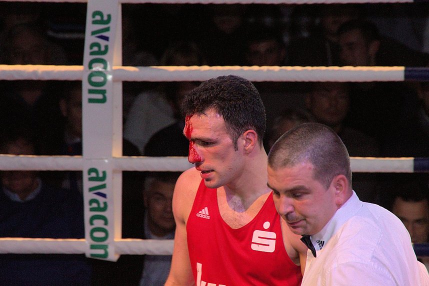 Niederlage in Hannover